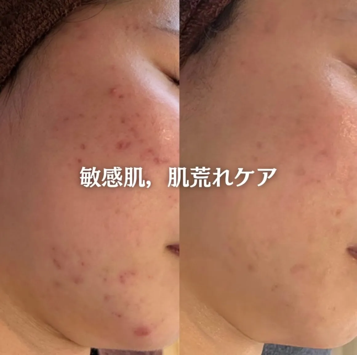@beautysalonfacile 👈🏻他投稿もチェック