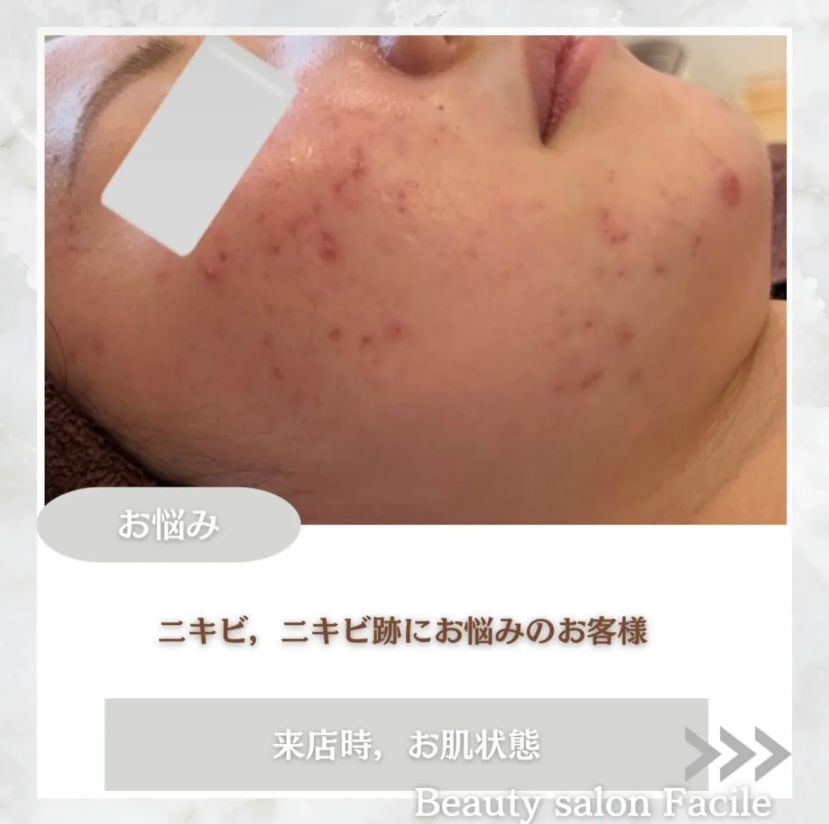 @beautysalonfacile 👈🏻他投稿もチェック
