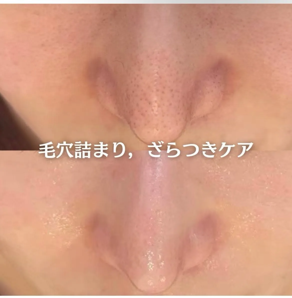@beautysalonfacile 👈🏻他投稿もチェック