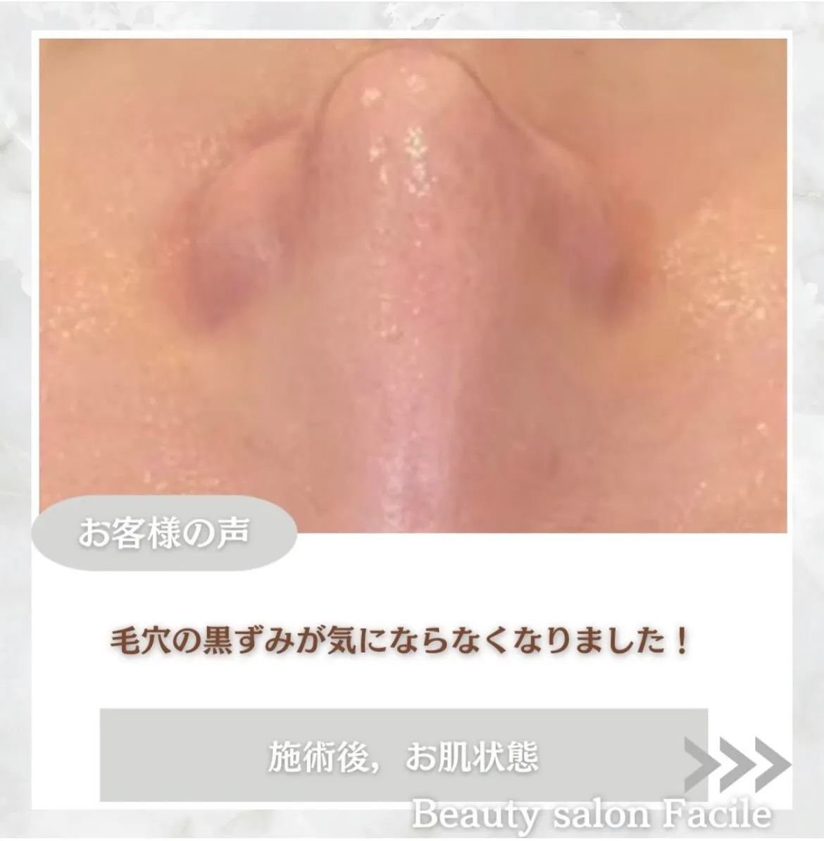 @beautysalonfacile 👈🏻他投稿もチェック