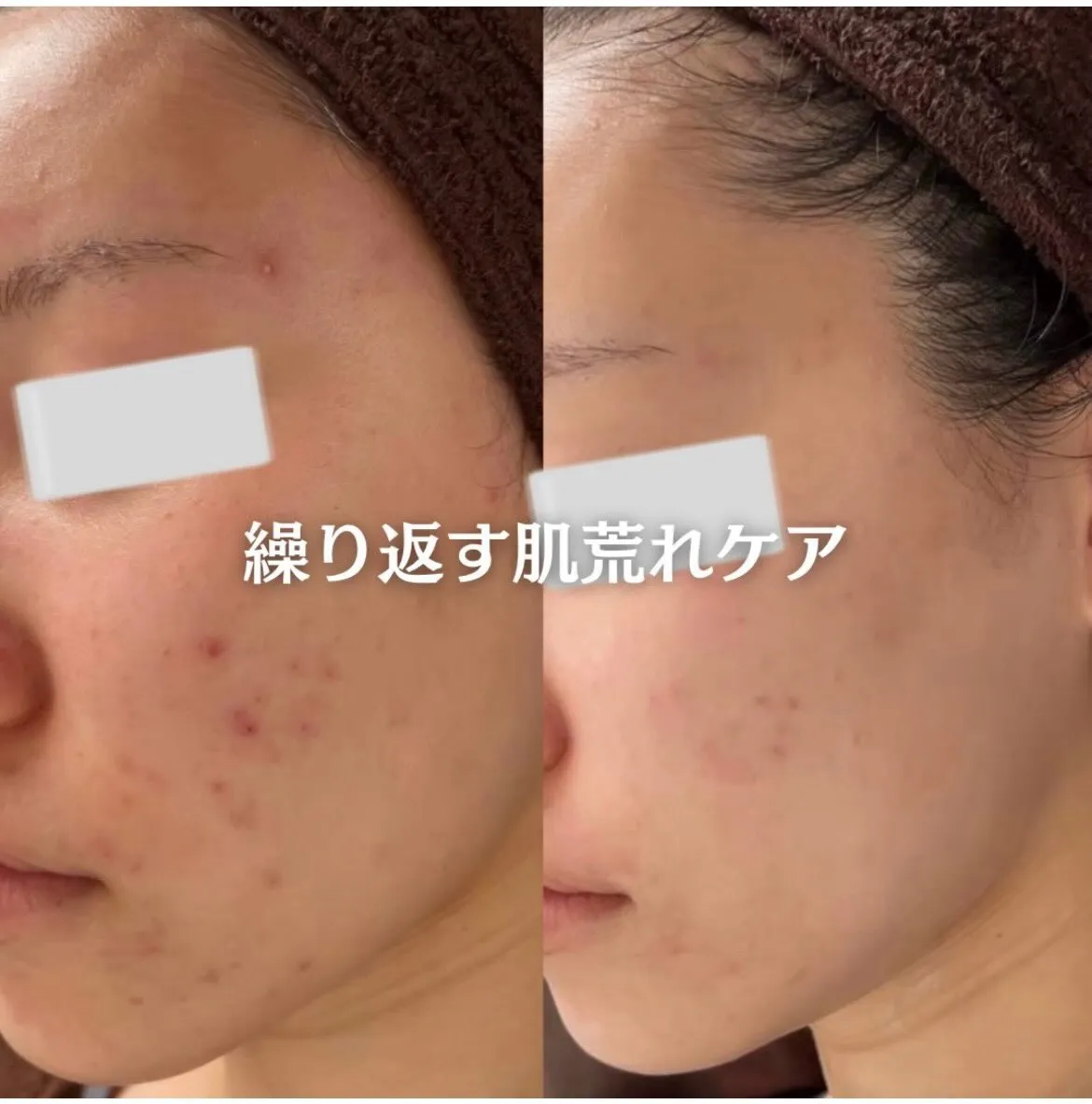 @beautysalonfacile 👈🏻他投稿もチェック
