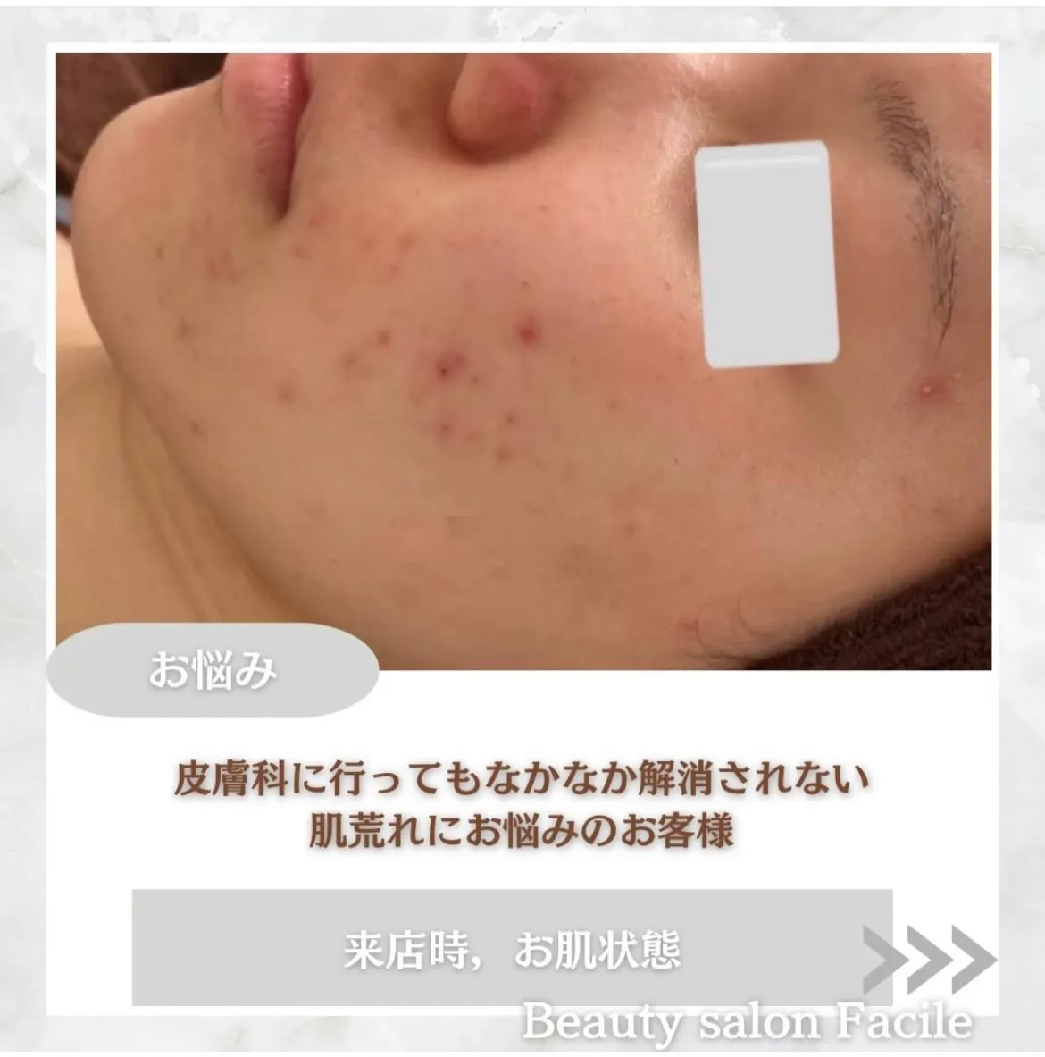 @beautysalonfacile 👈🏻他投稿もチェック
