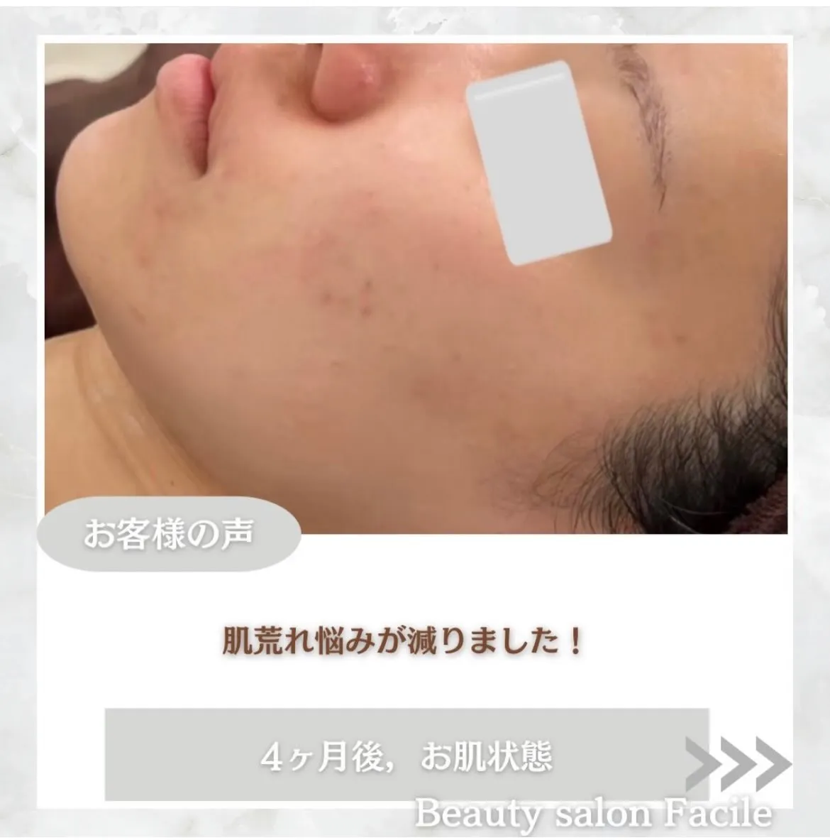 @beautysalonfacile 👈🏻他投稿もチェック