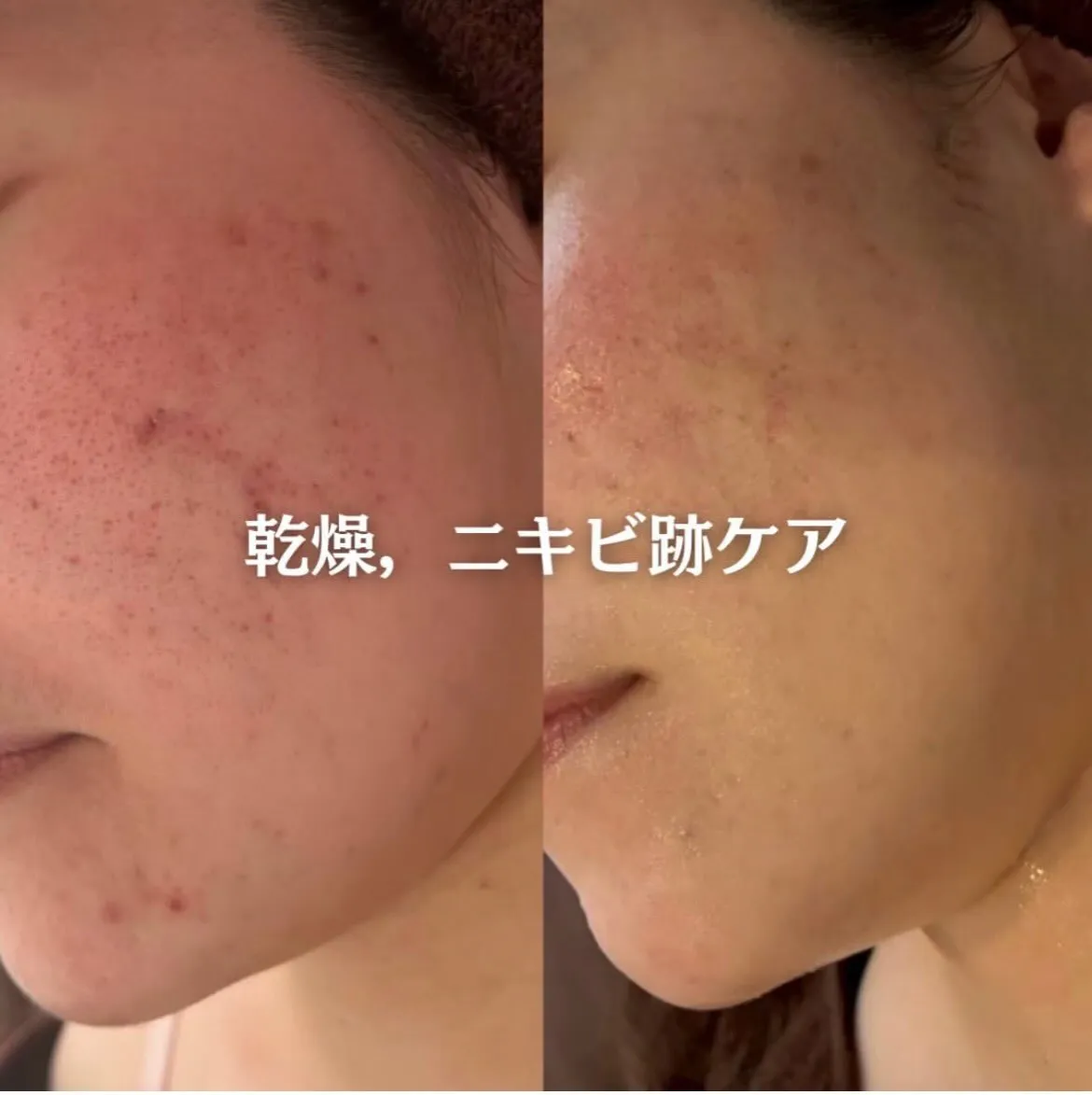 @beautysalonfacile 👈🏻他投稿もチェック