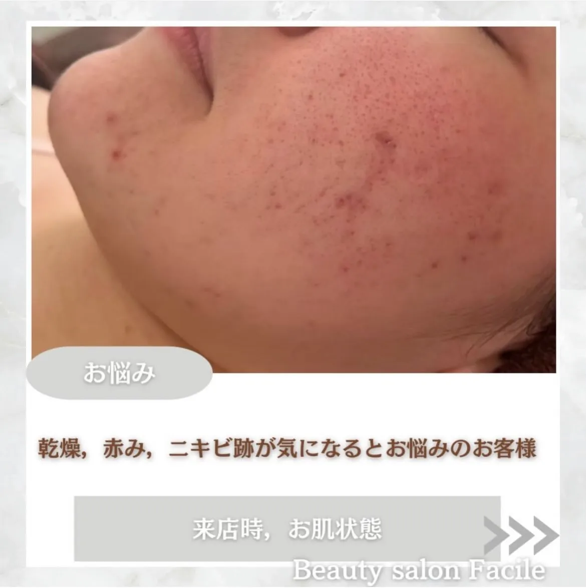 @beautysalonfacile 👈🏻他投稿もチェック