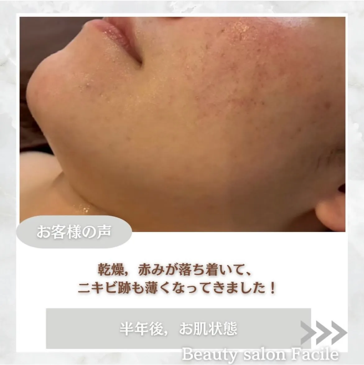 @beautysalonfacile 👈🏻他投稿もチェック