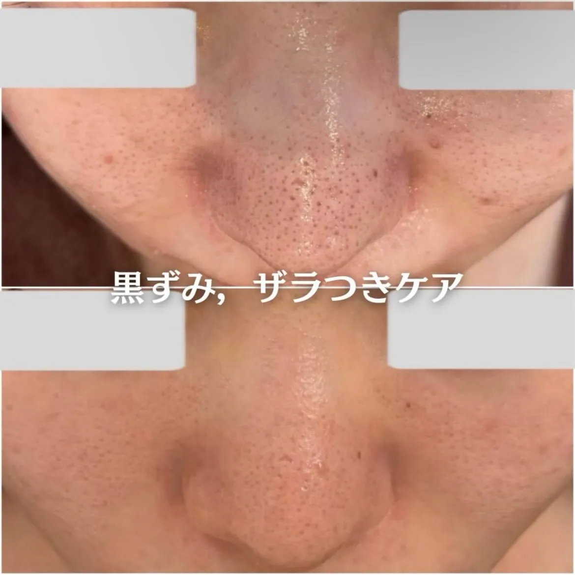 @beautysalonfacile 👈🏻他投稿もチェック