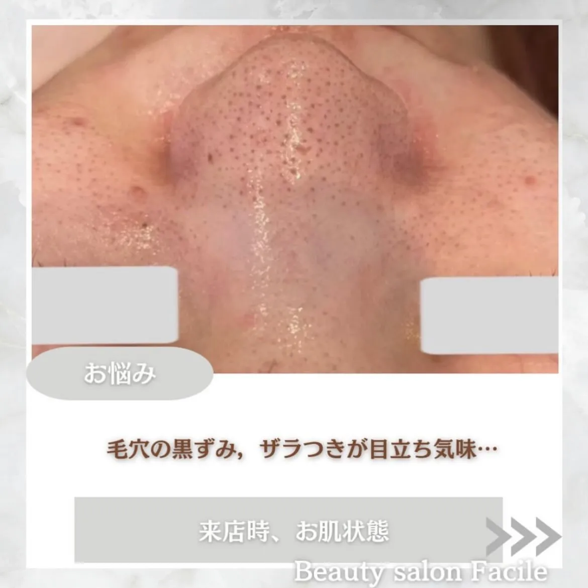 @beautysalonfacile 👈🏻他投稿もチェック