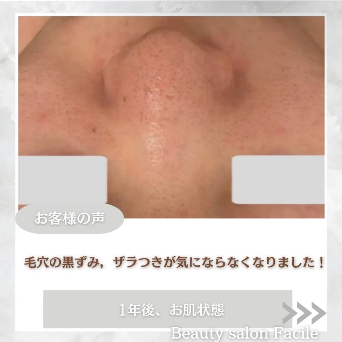 @beautysalonfacile 👈🏻他投稿もチェック