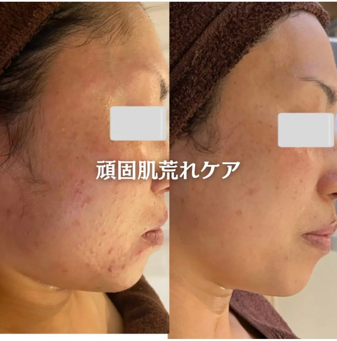 @beautysalonfacile 👈🏻他投稿もチェック