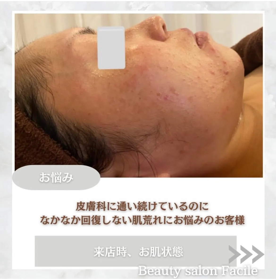 @beautysalonfacile 👈🏻他投稿もチェック