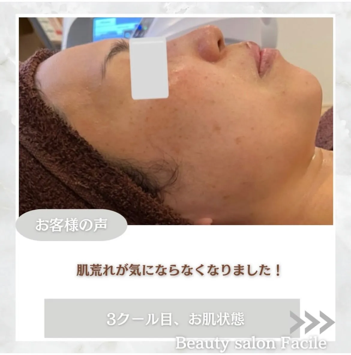@beautysalonfacile 👈🏻他投稿もチェック