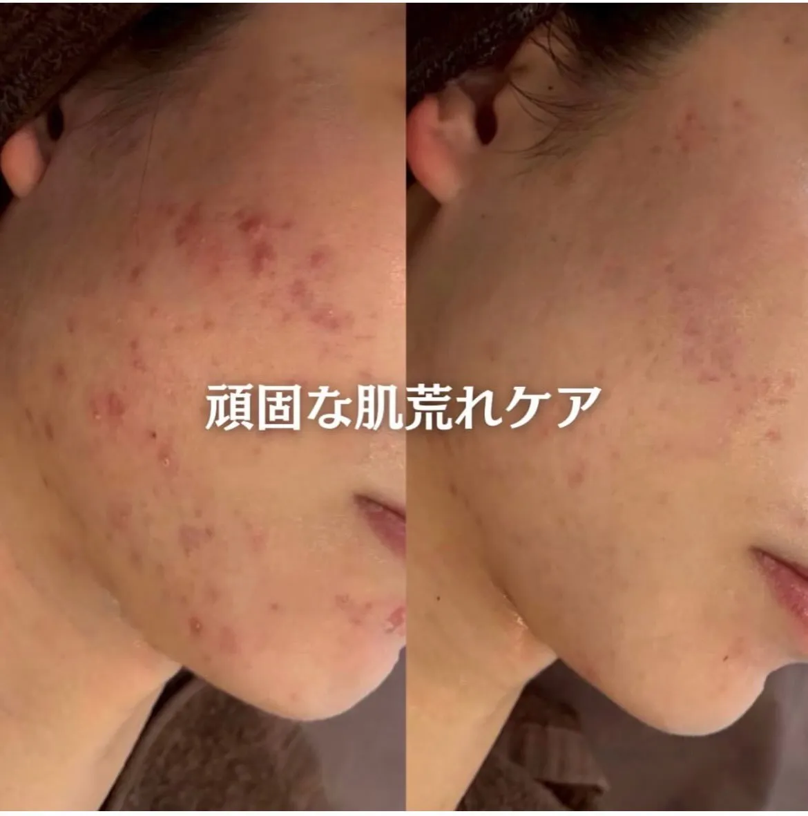 @beautysalonfacile 👈🏻他投稿もチェック