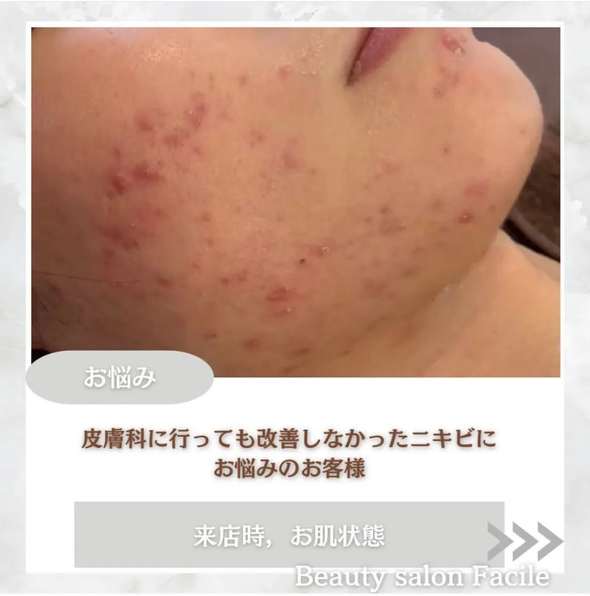 @beautysalonfacile 👈🏻他投稿もチェック