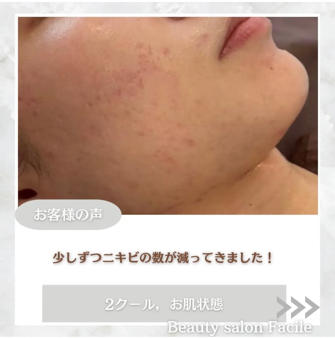 @beautysalonfacile 👈🏻他投稿もチェック