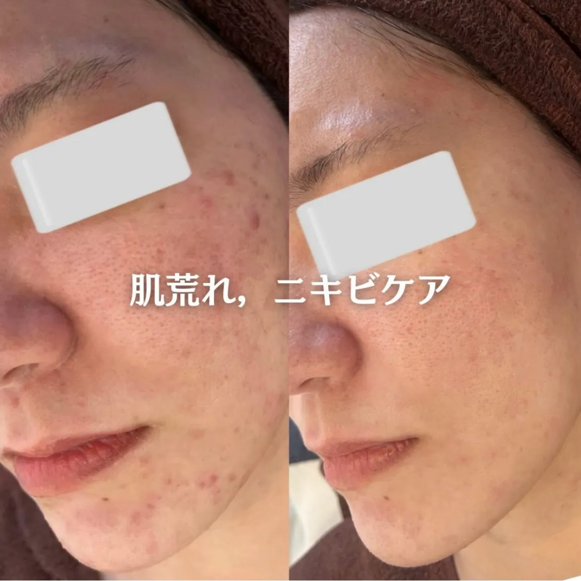 @beautysalonfacile 👈🏻他投稿もチェック