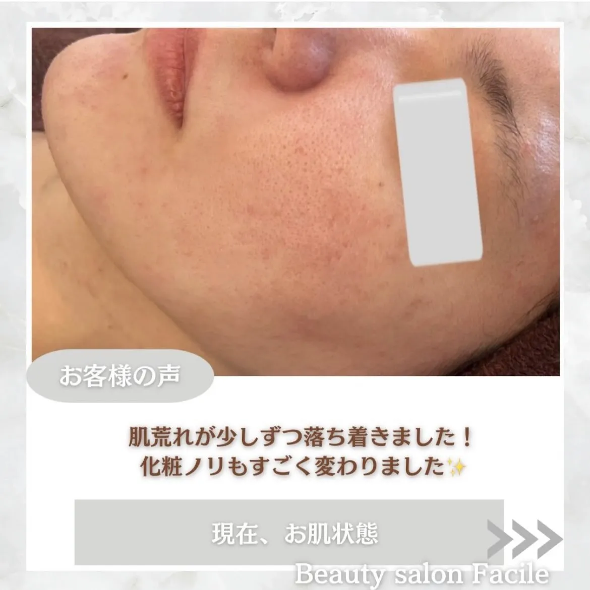 @beautysalonfacile 👈🏻他投稿もチェック