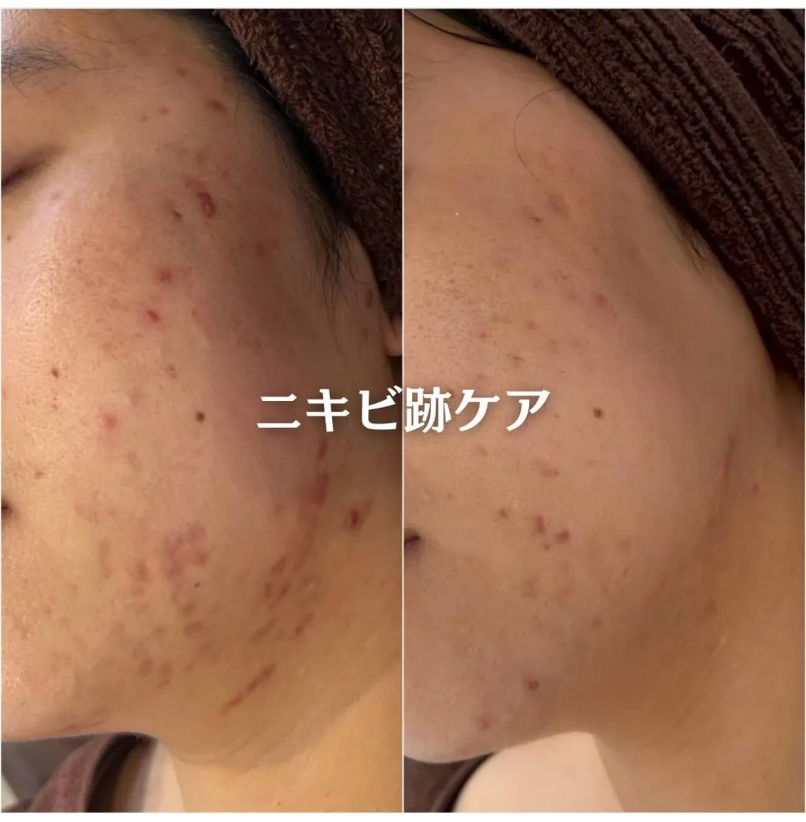 @beautysalonfacile 👈🏻他投稿もチェック