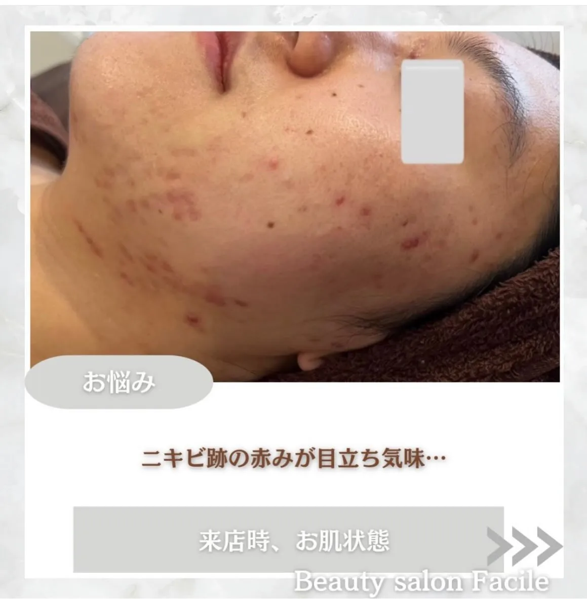 @beautysalonfacile 👈🏻他投稿もチェック