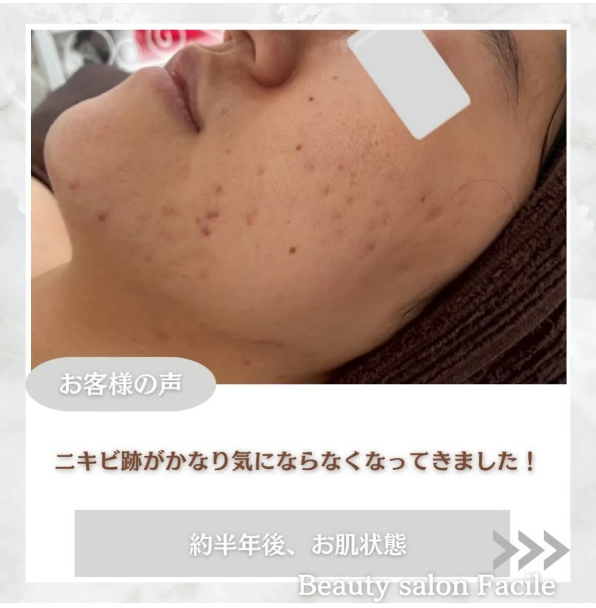 @beautysalonfacile 👈🏻他投稿もチェック