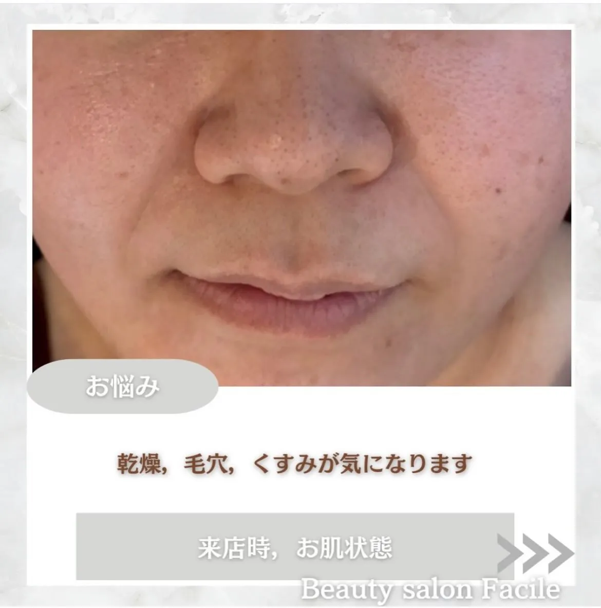 @beautysalonfacile 👈🏻他投稿もチェック