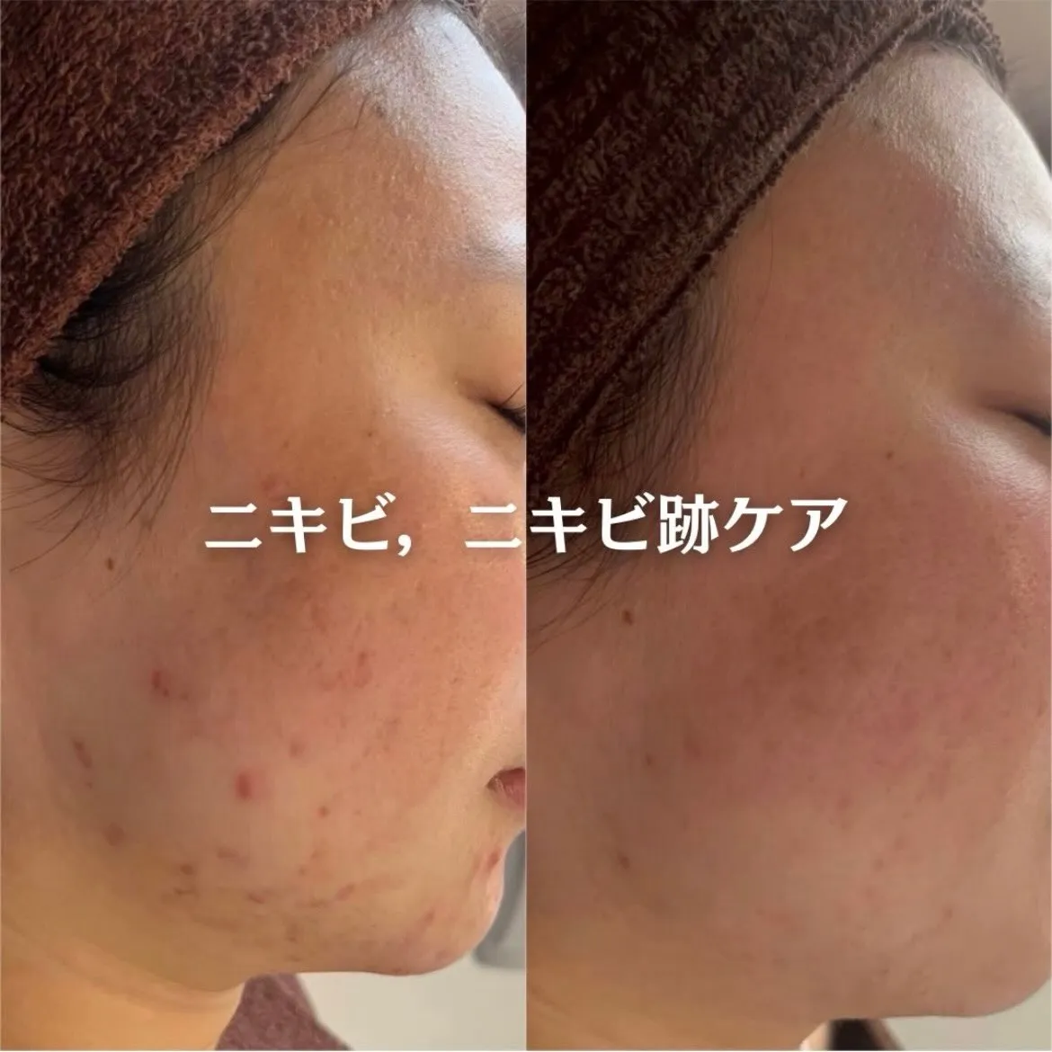 @beautysalonfacile 👈🏻他投稿もチェック