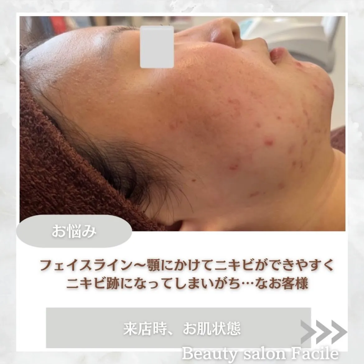 @beautysalonfacile 👈🏻他投稿もチェック