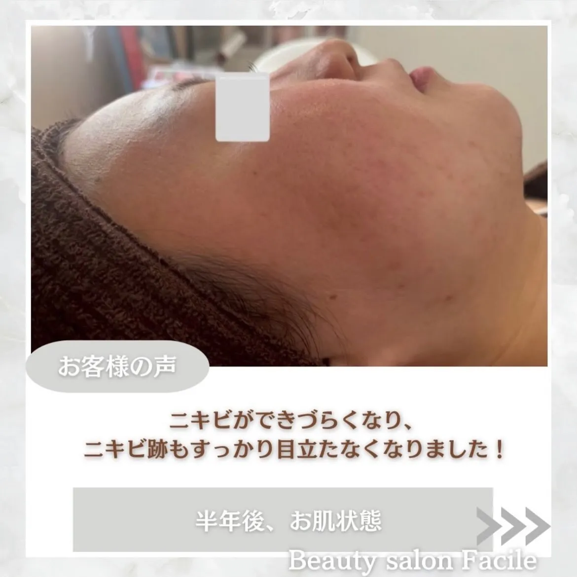 @beautysalonfacile 👈🏻他投稿もチェック