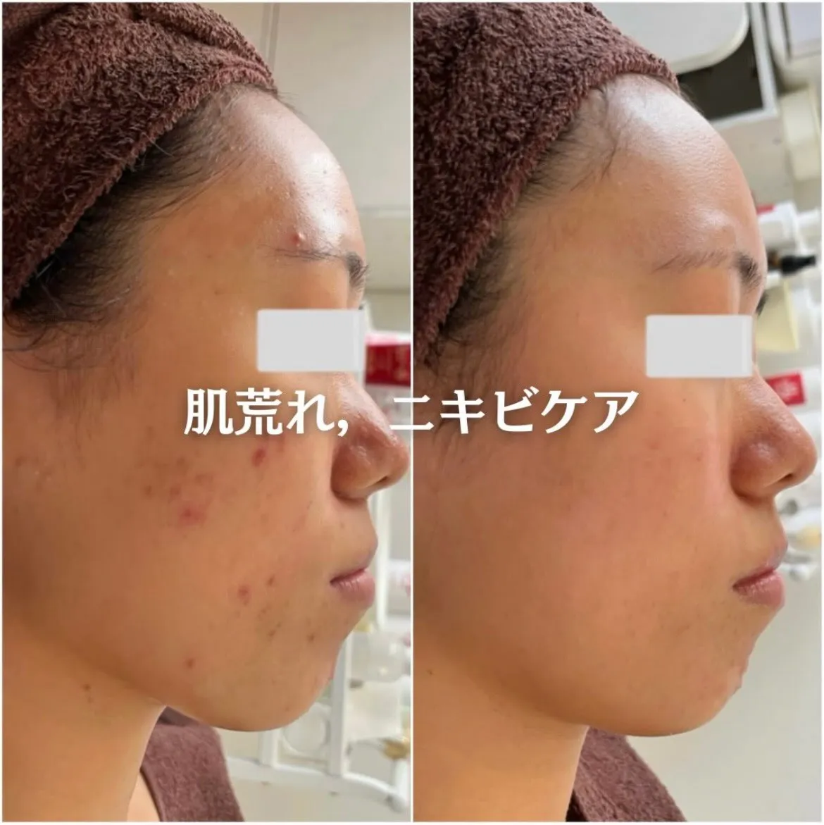 @beautysalonfacile 👈🏻他投稿もチェック