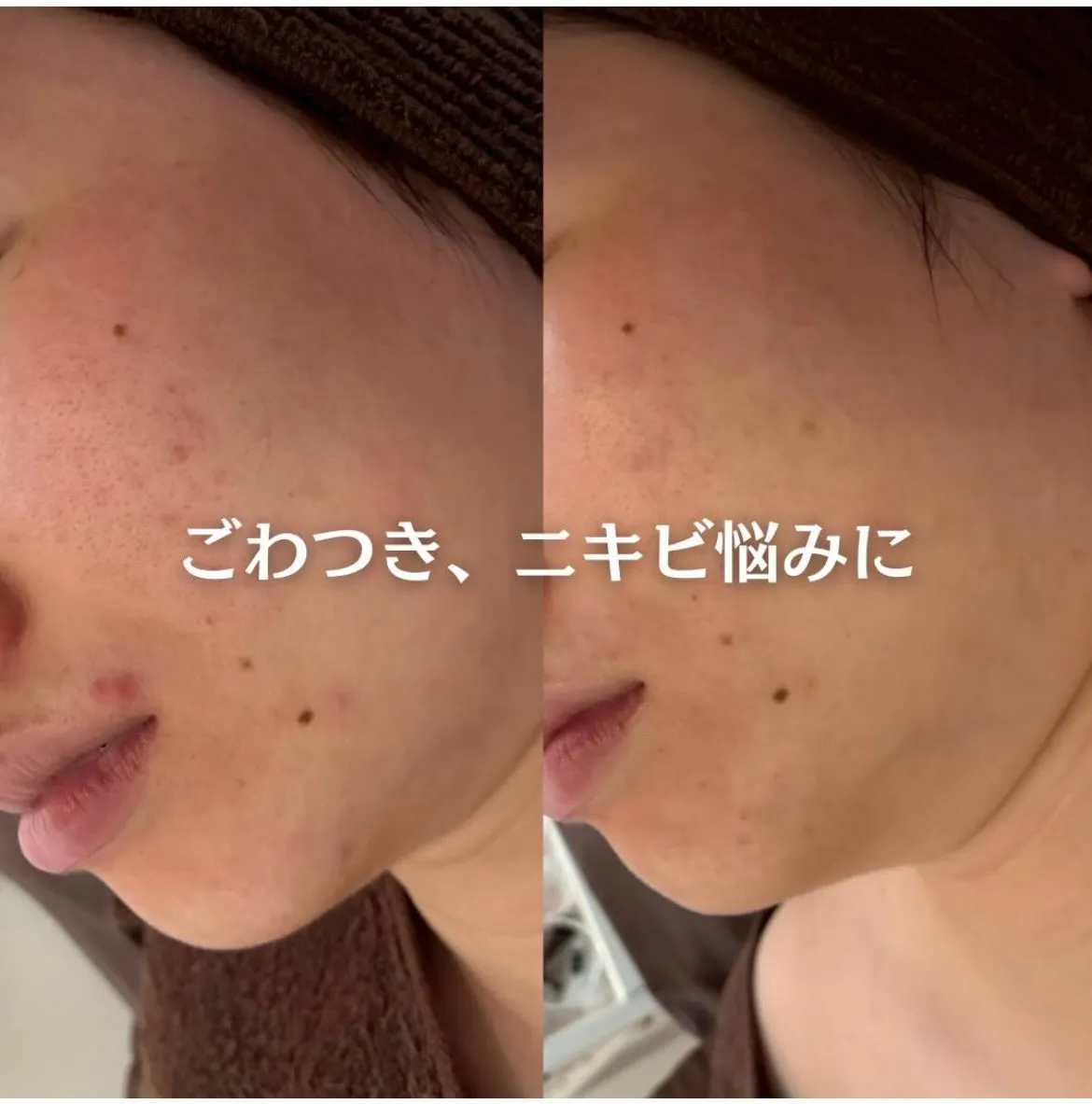 @beautysalonfacile 👈🏻他投稿もチェック