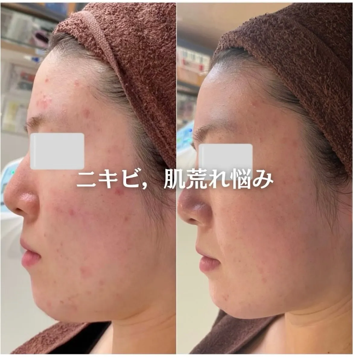 @beautysalonfacile 👈🏻他投稿もチェック