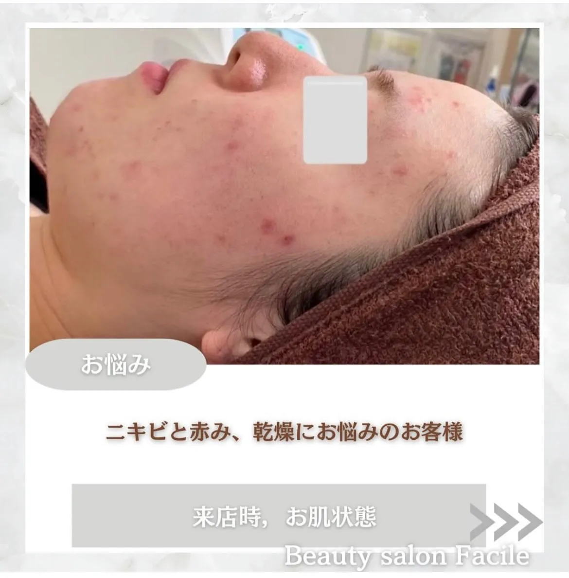 @beautysalonfacile 👈🏻他投稿もチェック