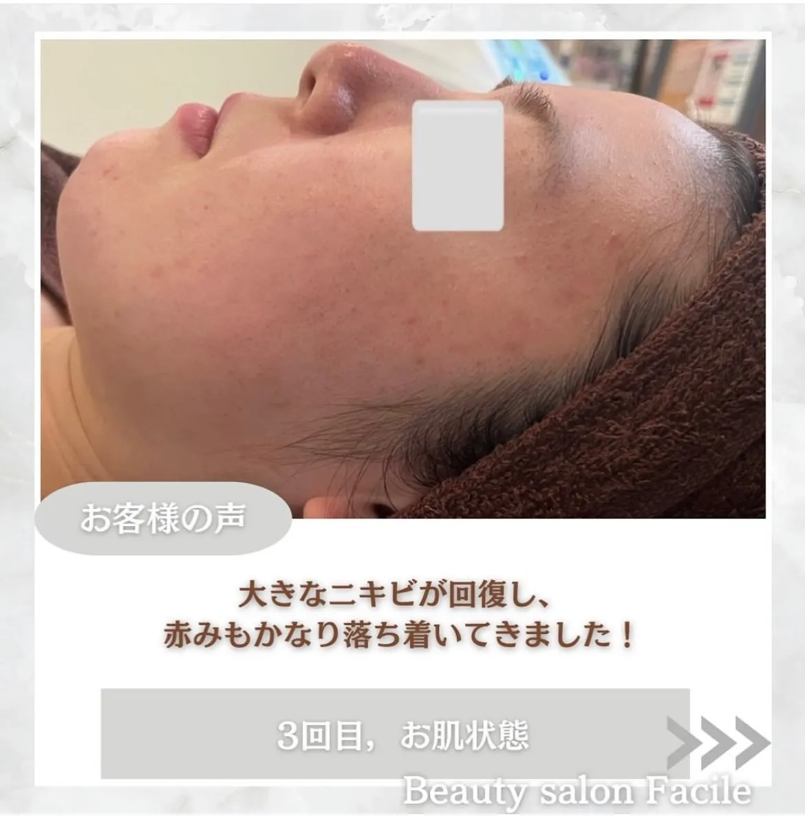 @beautysalonfacile 👈🏻他投稿もチェック