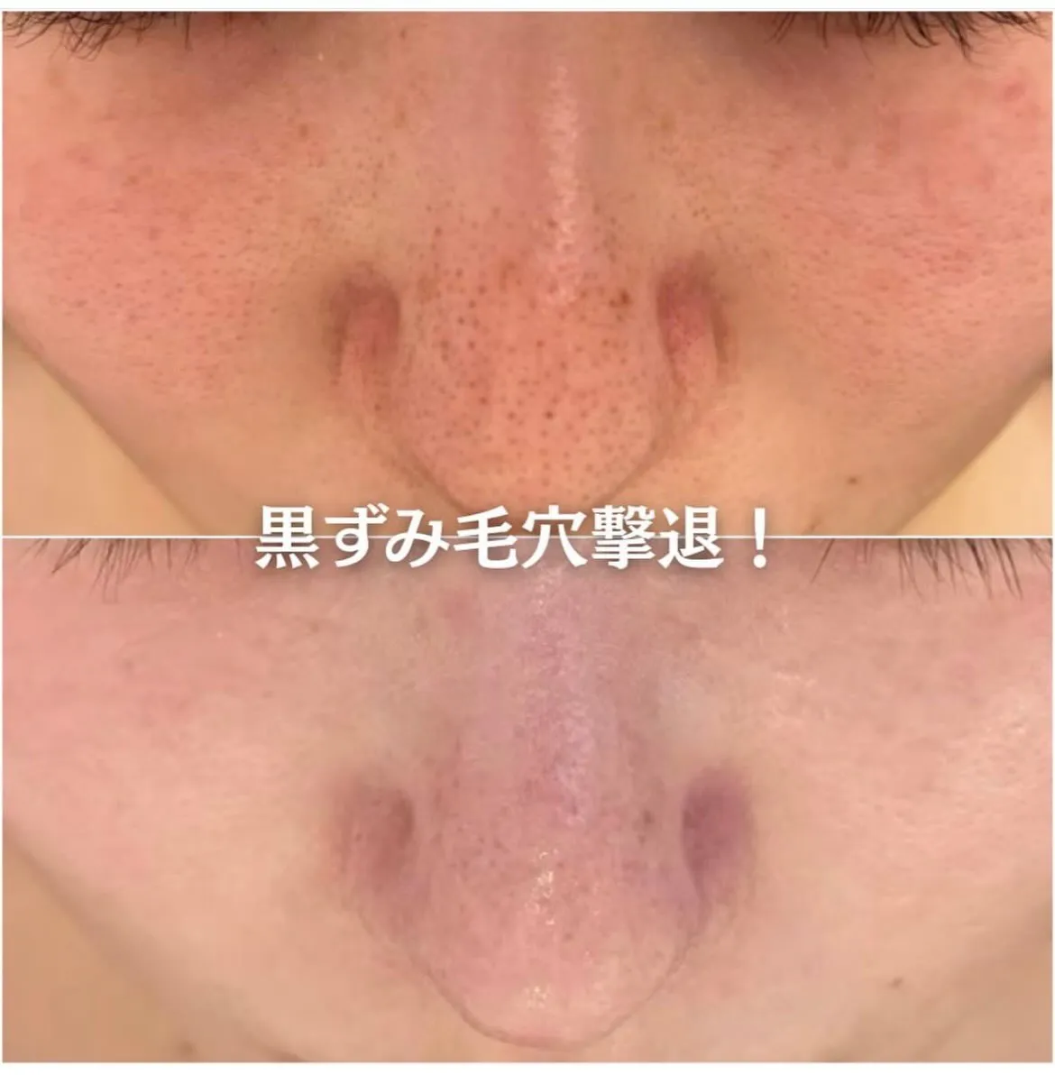@beautysalonfacile 👈🏻他投稿もチェック
