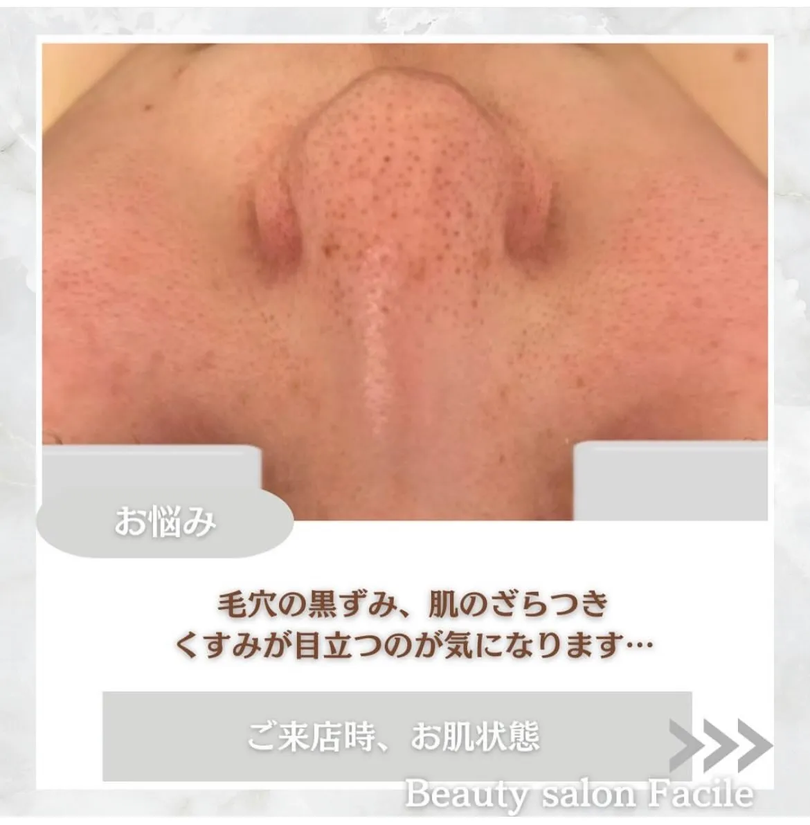 @beautysalonfacile 👈🏻他投稿もチェック