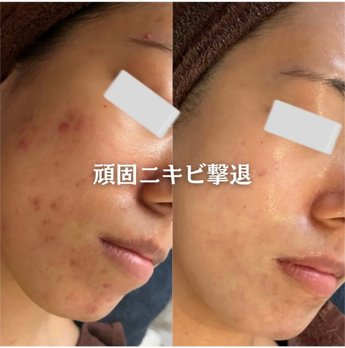 @beautysalonfacile 👈🏻他投稿もチェック