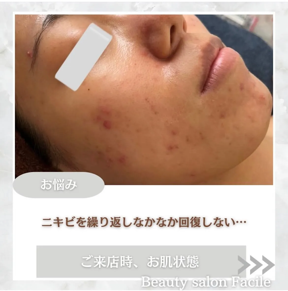 @beautysalonfacile 👈🏻他投稿もチェック