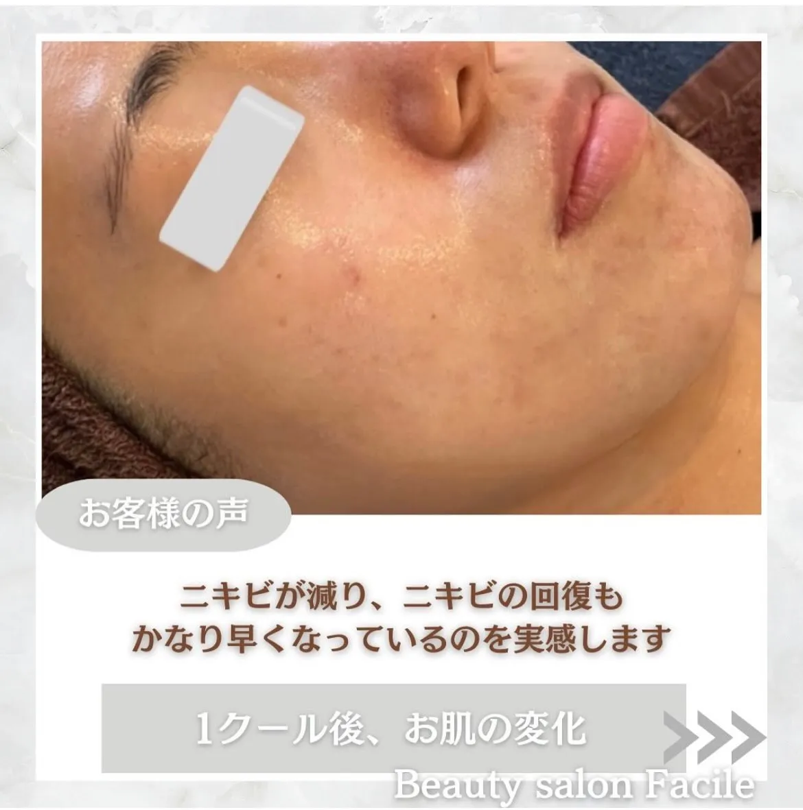 @beautysalonfacile 👈🏻他投稿もチェック