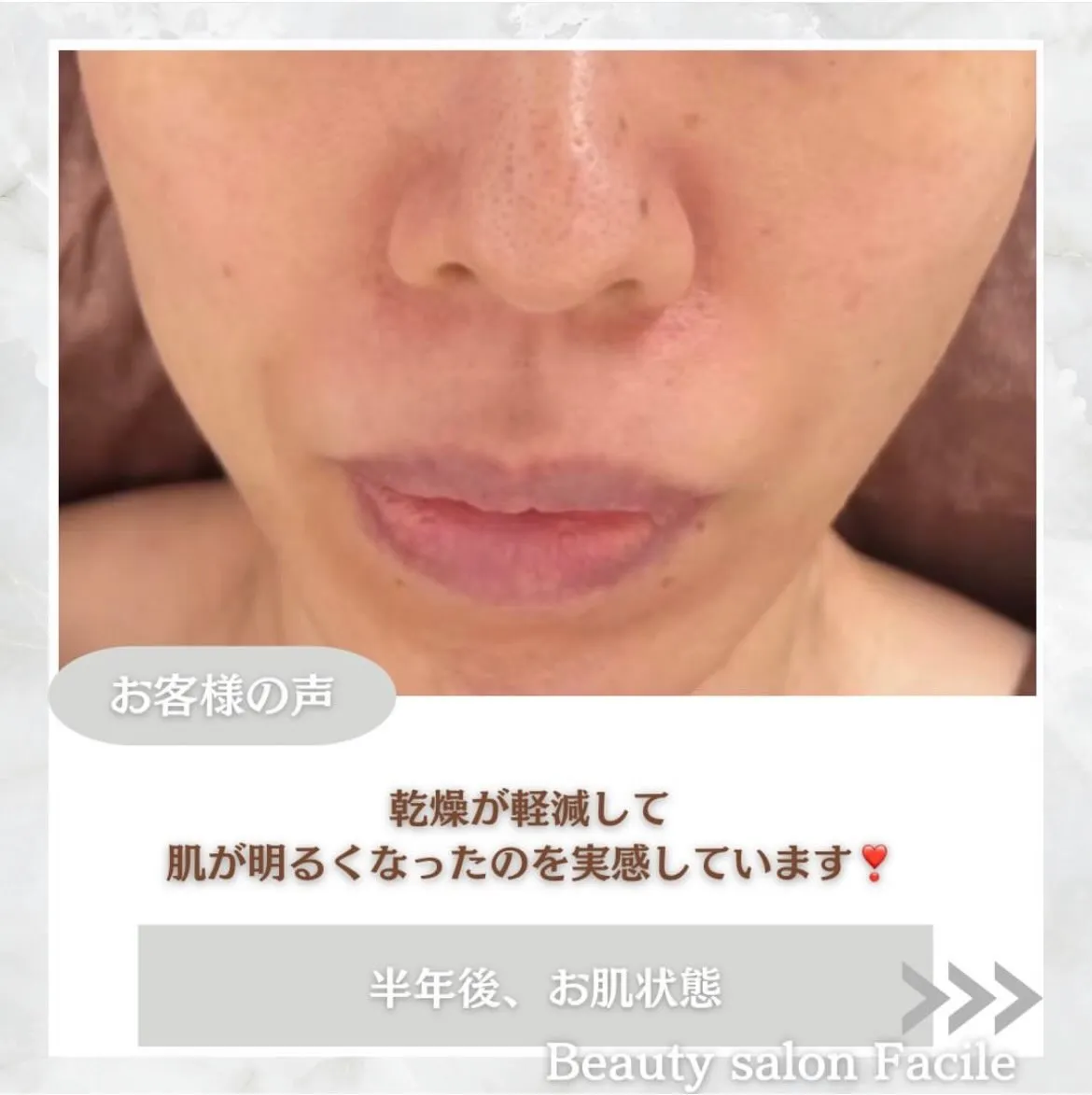 @beautysalonfacile 👈🏻他投稿もチェック